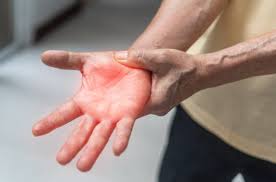 How to Navigate Peripheral Neuropathy Causes, Symptoms and Management