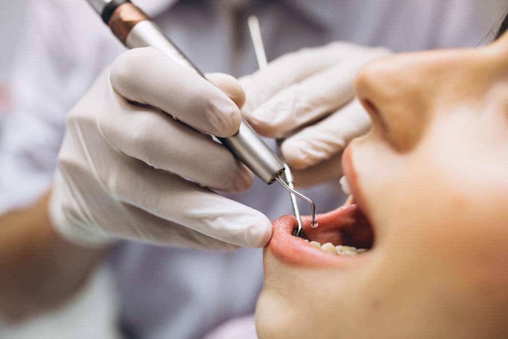 How to Prepare for Your Root Canal Appointment